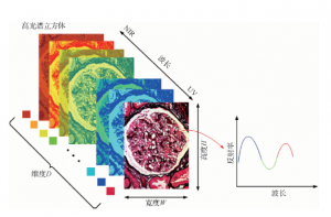高光譜圖像技術在醫(yī)學診斷中的重要性